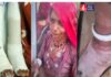 90 साल की महिला के साथ बड़ा मेडिकल ब्लंडर, बाएं की जगह दाएं पैर का ऑपरेशन Jodhpur Medical Case