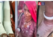90 साल की महिला के साथ बड़ा मेडिकल ब्लंडर, बाएं की जगह दाएं पैर का ऑपरेशन Jodhpur Medical Case