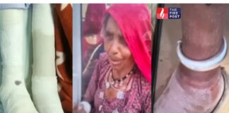 90 साल की महिला के साथ बड़ा मेडिकल ब्लंडर, बाएं की जगह दाएं पैर का ऑपरेशन Jodhpur Medical Case