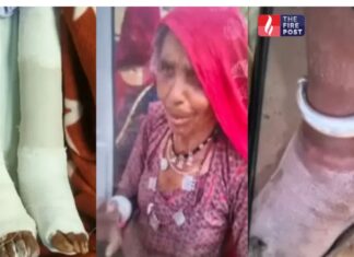 90 साल की महिला के साथ बड़ा मेडिकल ब्लंडर, बाएं की जगह दाएं पैर का ऑपरेशन Jodhpur Medical Case