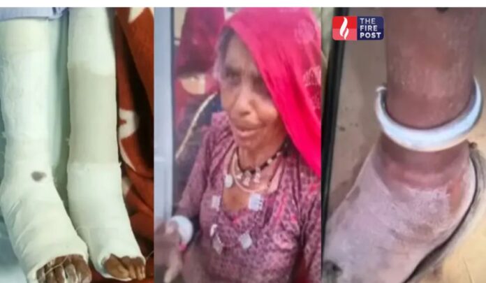 Jodhpur Medical Case